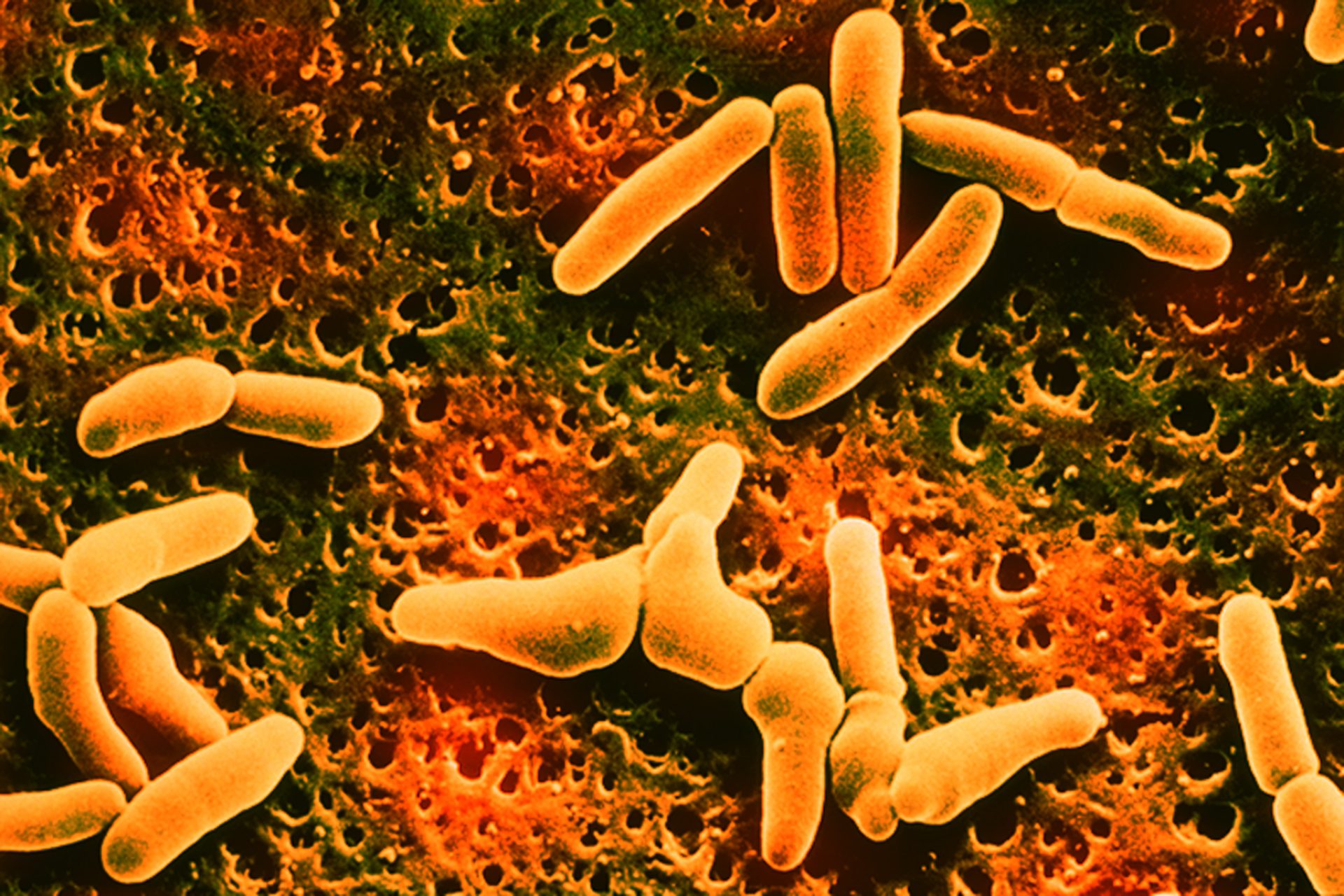 Recent Listeria Outbreak Leaves One Person Dead And 22 Hospitalized