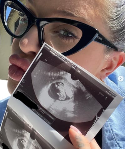 Kelly Osbourne and Sonogram