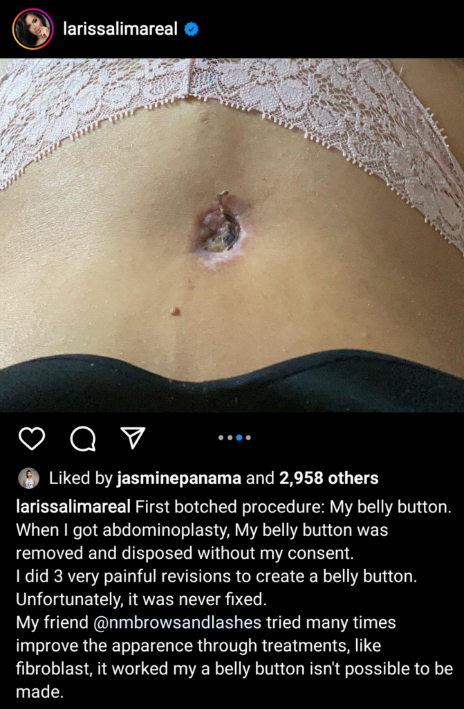 Larissa Lima: My Surgeon Stole My Friggen Bellybutton! 