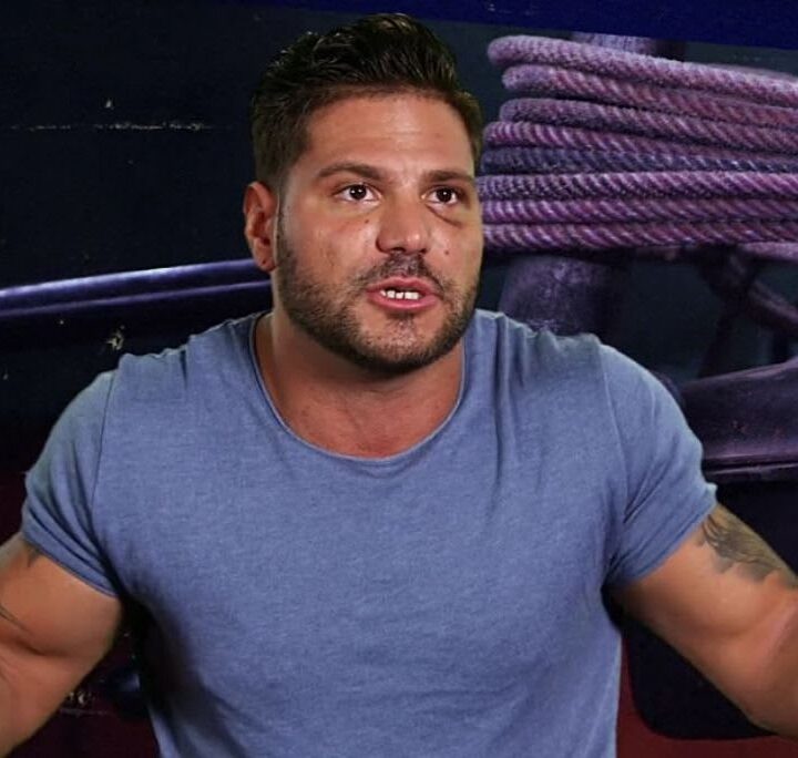 Ronnie Ortiz-Magro with Black Eye