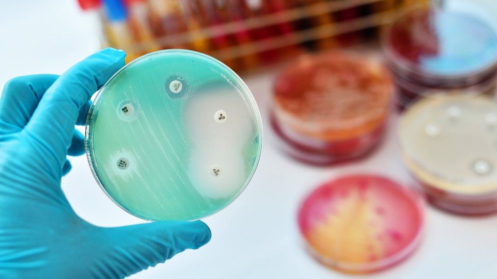 Petri dish with bacteria