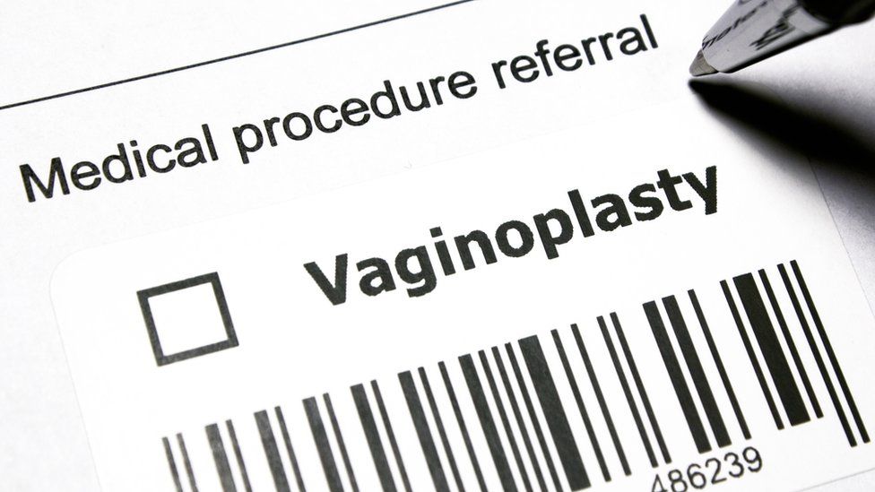 Vaginoplasty