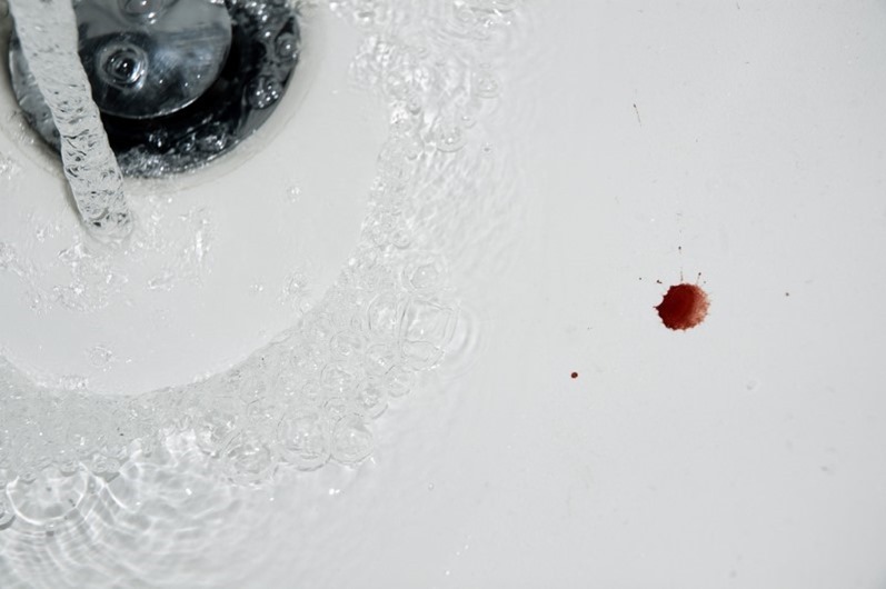 blood-in-sink