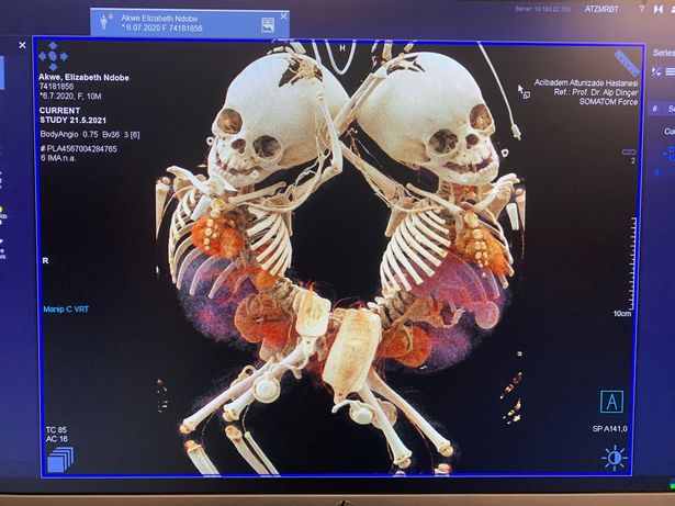 An X-ray image of Elizabeth and Mary Akwe