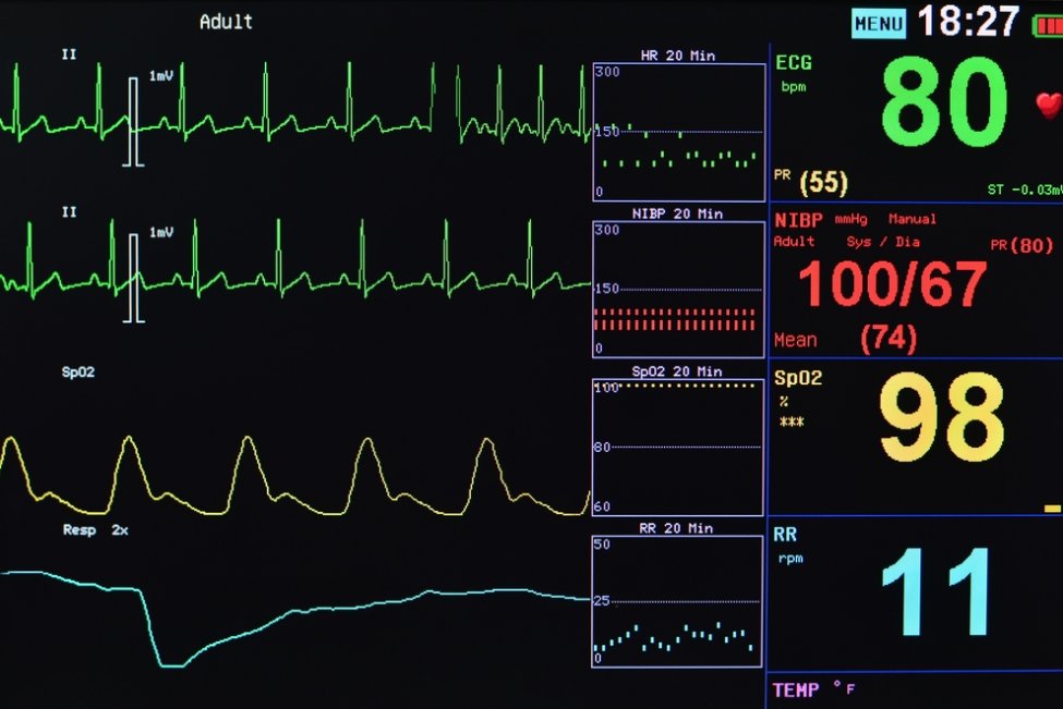 COVID-19 raises risk for cardiac arrest death, study finds