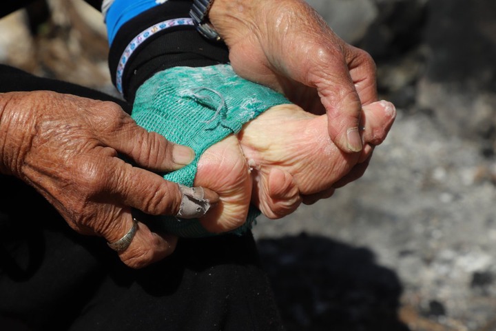 Chinas Worst Tradition Foot Binding And How It Left Many Women