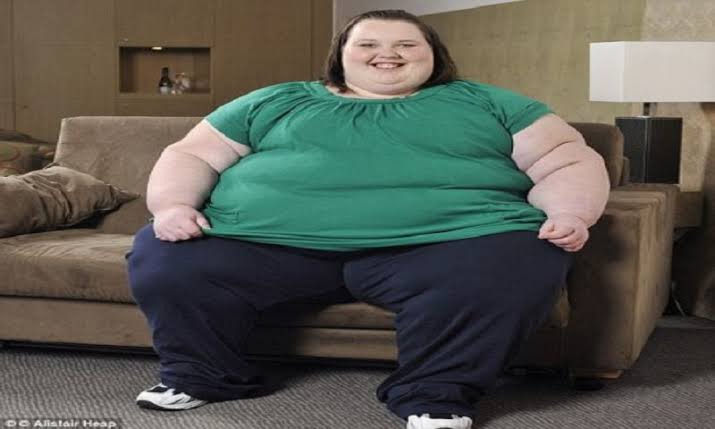 Here Are Photos Of Obese People In The World And The Possible Causes Of ...