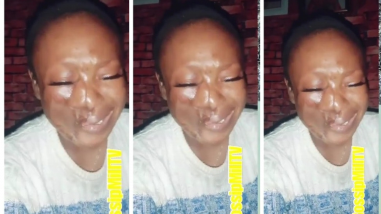 No man wants to marry me because of my deformed face – Lady weeps