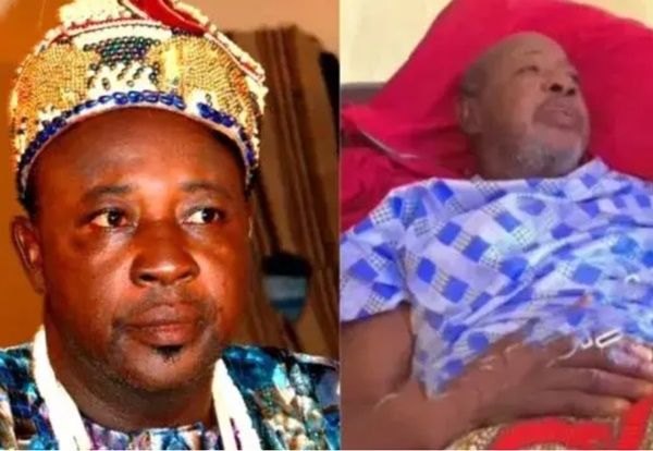 Another Popular Nollywood Actor Begs For Help Over Health Challenges |
